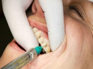 При анестезии зуба попали в нерв последствия
